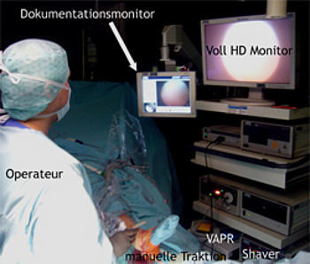 Arthroskopieturm mit "Voll-HD"-Technik, Dokumentationssystem, Shaver und Vaper und Einsatz der manuellen Traktion.