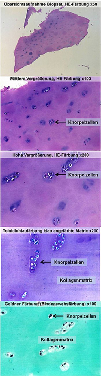 Histologische Bilder einer Probe