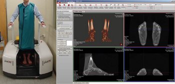 Beispiel für verschiedene Winkelmessungen im 3D-Datansatz des PedCAT