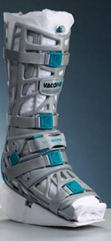 Vacoped® Orthese zur funktionellen Behandlung der Achillessehnenruptur.