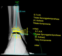 Computergestützte Planung für die STAR®