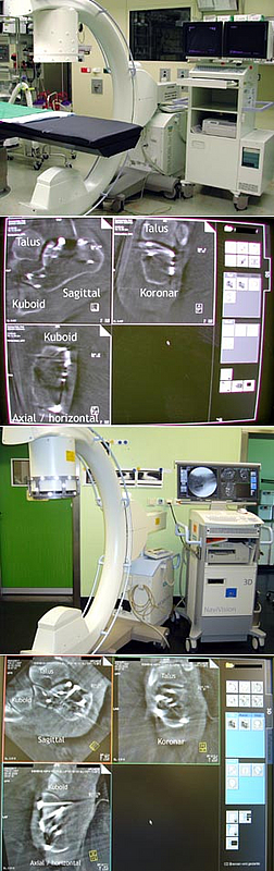 ISO-C-3D (Siemens, Erlangen, Abbildung 1a) und der ARCADIS-3D (Siemens, Erlangen, Abbildung 1c).