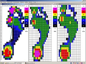 Bilder von Schritt 1 der Validierungsstudie: links, Pedographie mit KIOP