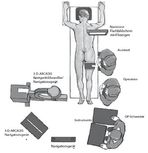 Navigationssystem (Navivision, Fa. Brainlab, Heimstetten) inkl. Röntgenbildverstärker (ARCADIS-3D, Siemens, Erlangen) und Personal. 