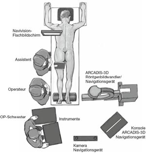 Lagerung des Patienten und Positionierung von Navigationssystem und Personal.