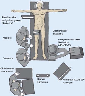 Lagerung des Patienten und Positionierung von Navigationssystem (Navivision) inkl. Röntgenbildverstärker (ARCADIS-3D) und Personal.