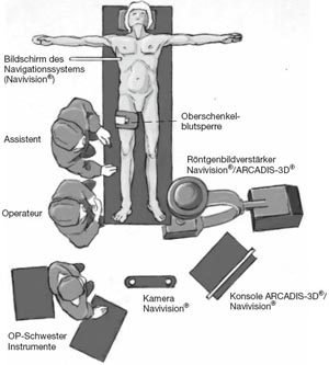 Lagerung des Patienten und Positionierung von Navigationssystem (Navivision, Brainlab, Heimstetten) inkl. Röntgenbildverstärker (ARCADIS-3D, Siemens, Erlangen) und Personal.