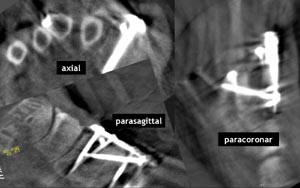 Intraoperative 3D-Bilder.