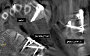 Intraoperative 3D-Bilder. 