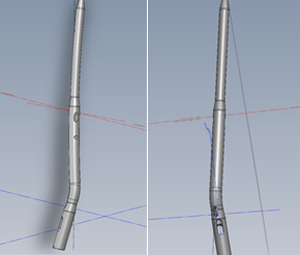 A3/B4 Nagel mit distaler Biegung nach lateral und posterior und proximaler Biegung im Sinne einer leichten Rekurvation